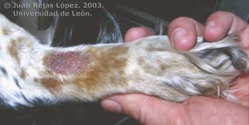 dermatitis acral